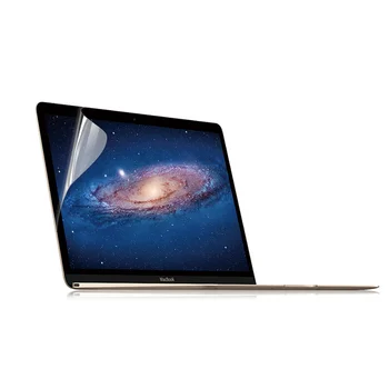 Viso Kūno Odos MacBook Pro 15 colių Modelis A1707/A1990, Su Viršų Odos , Apačioje Odos, Touchpad Odos, Palmių Poilsio Odos,Ekrano plėvelės